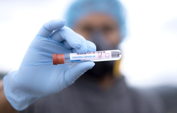 Jalisco alcanza récord de casos activos Covid desde que comenzó la pandemia