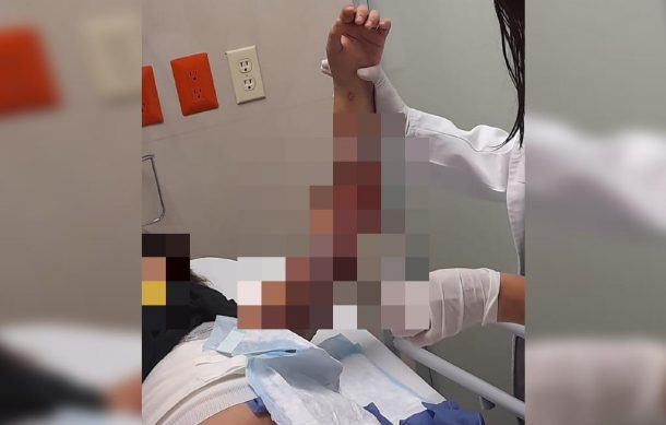 Prenden fuego a niña dentro de albergue en Tonalá