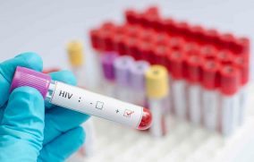 Retraso en diagnósticos de VIH eleva muertes en México