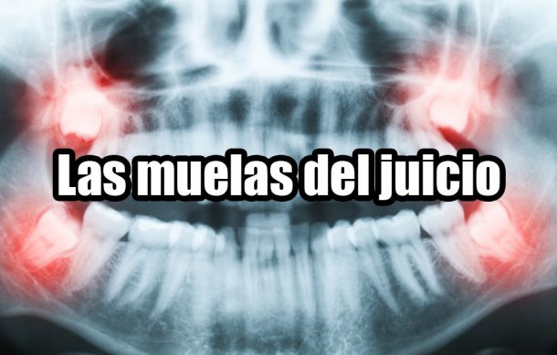 Las muelas del juicio