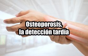 Osteoporosis, la detección tardía