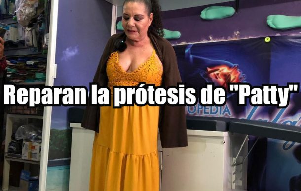 Reparan la prótesis de “Patty”