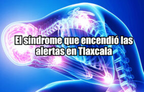 El síndrome que encendió las alertas en Tlaxcala