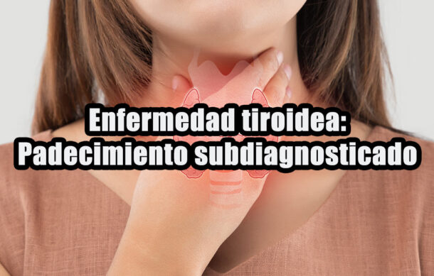 Enfermedad tiroidea: Padecimiento subdiagnosticado