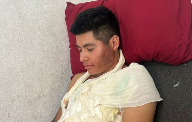 Joven resulta con quemaduras tras choque de camioneta contra puesto de tacos