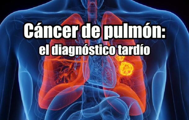 Cáncer de pulmón: el diagnóstico tardío