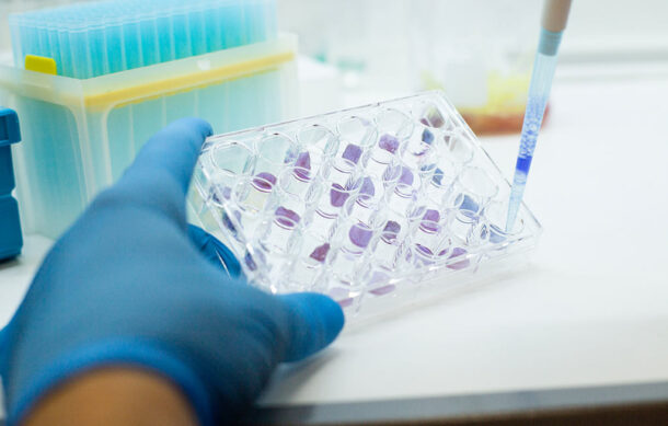 Realizará FGR jornada de toma de muestras de ADN por hallazgos en Rancho Izaguirre