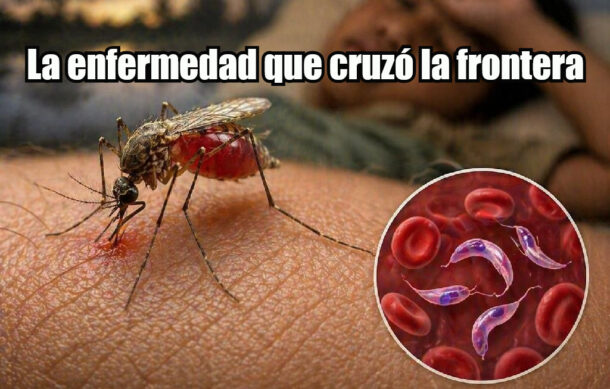 La enfermedad que cruzó la frontera